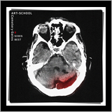 ART-SCHOOL、入手困難なCDからも選曲した史上初のBサイドベスト盤を1/25にリリース